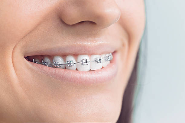 Best Wisdom Tooth Removal  in Hawkins, TX